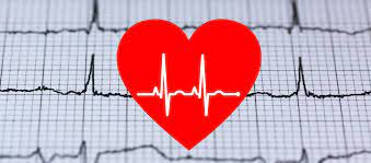 Zawał serca, migotanie przedsionków