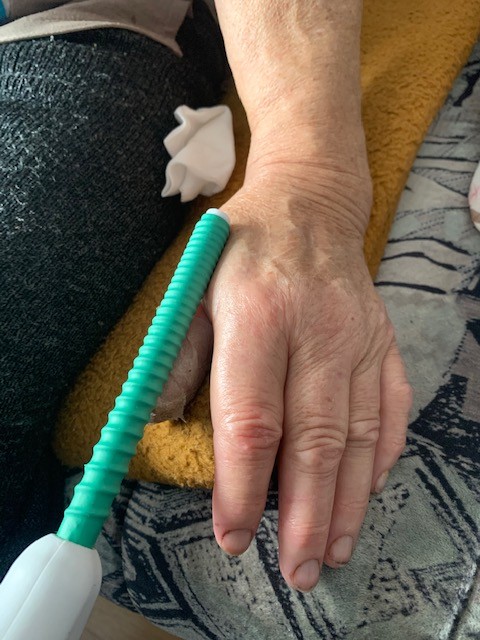 Bóle kostno-stawowe